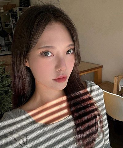 올리팅성형외과 리얼셀피 06