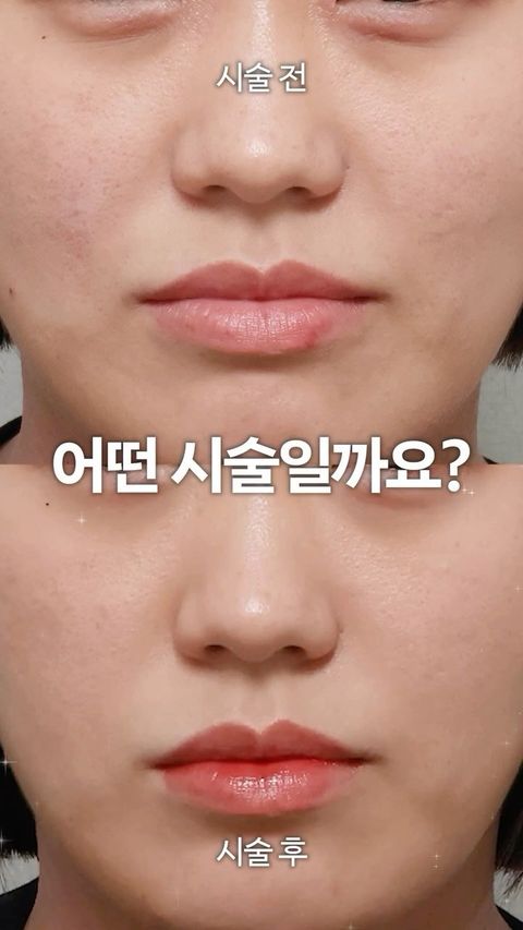 쥬브아셀
